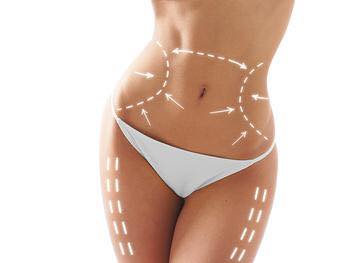 body contouring Beaumont TX, micro-needling Beaumont TX, day spa Beaumont TX, Med Spa Beaumont TX, bridal fair Beaumont TX
